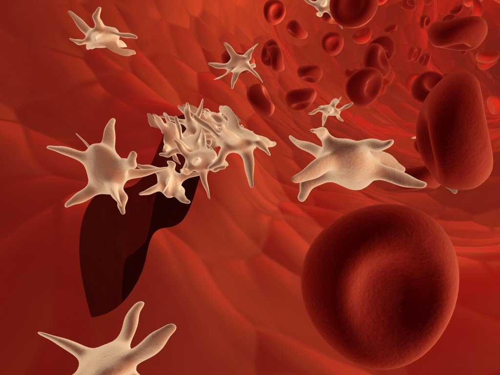 При лейкозе в анализе крови наблюдается лейкоцитоз thumbnail