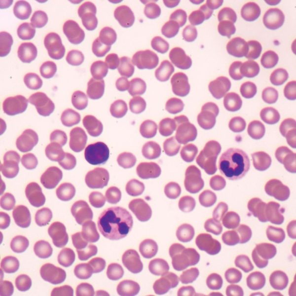 Нейтрофилы в крови человека