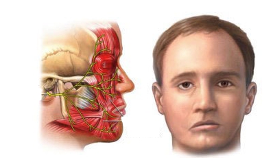Спазм лицевых мышц