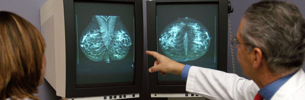 Врач изучает маммограмму груди